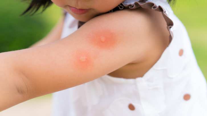 In late July, the Florida Department of Health (DOH) issued an alert warning that the risk of transmission of the virus—Eastern equine encephalitis, or EEE—has increased in humans in our state.